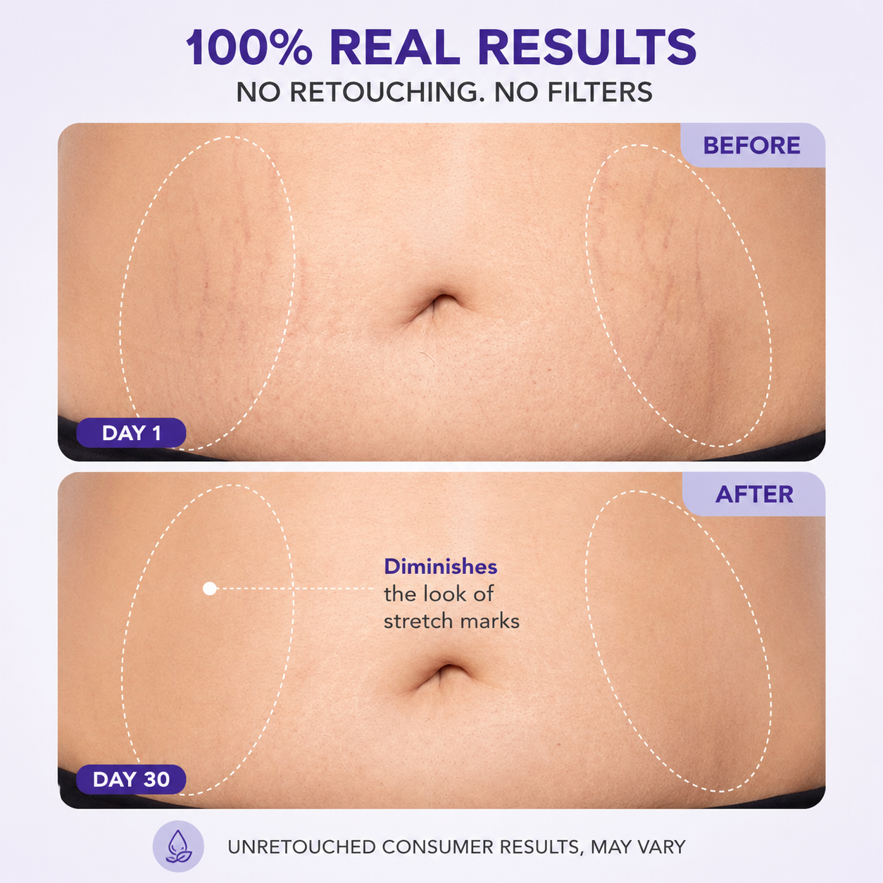 Edertas Firming Belly Cream – For Smoother, Tighter-Looking Skin