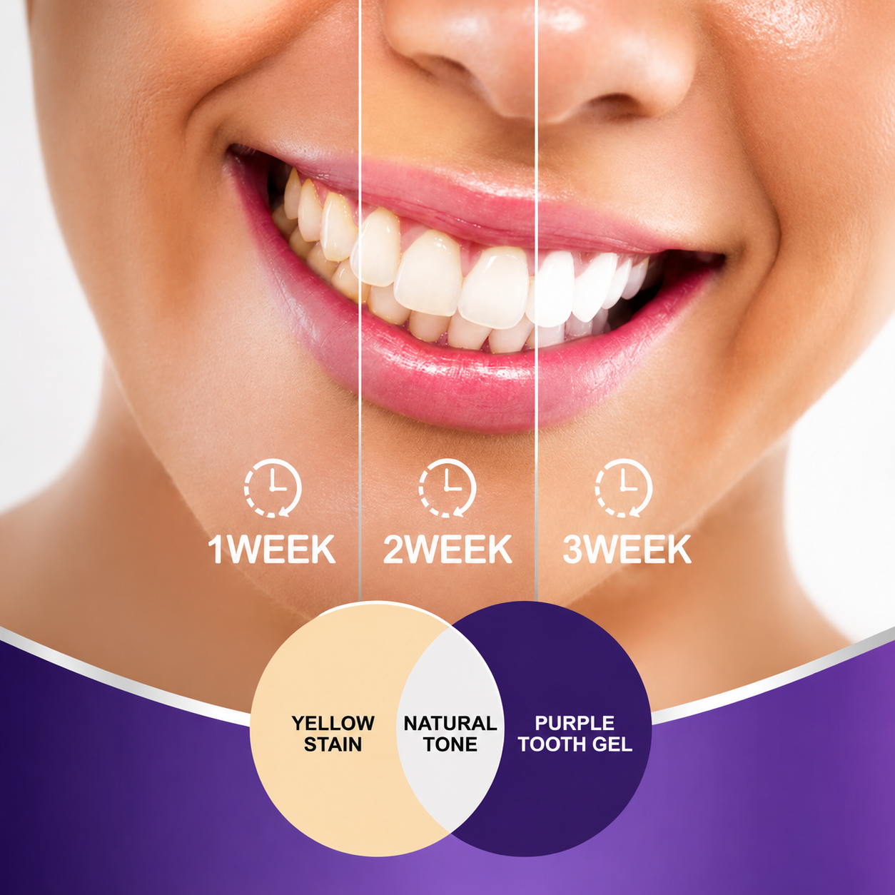 Hismiles Purple Toothpaste – Color Correcting Teeth Brightener