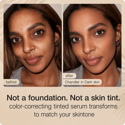 Edertas Skin Veil Serum BB Cream – Covers Dark Spots Without Looking Cakey